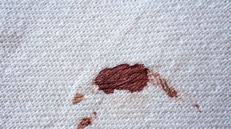 Period Stain, Blood Out Of Carpet, Remove Blood Stains, Chocolate Stains, Clean Car Carpet, Carpet Cleaning Business, Removing Carpet, Deep Carpet Cleaning, Diy Carpet Cleaner