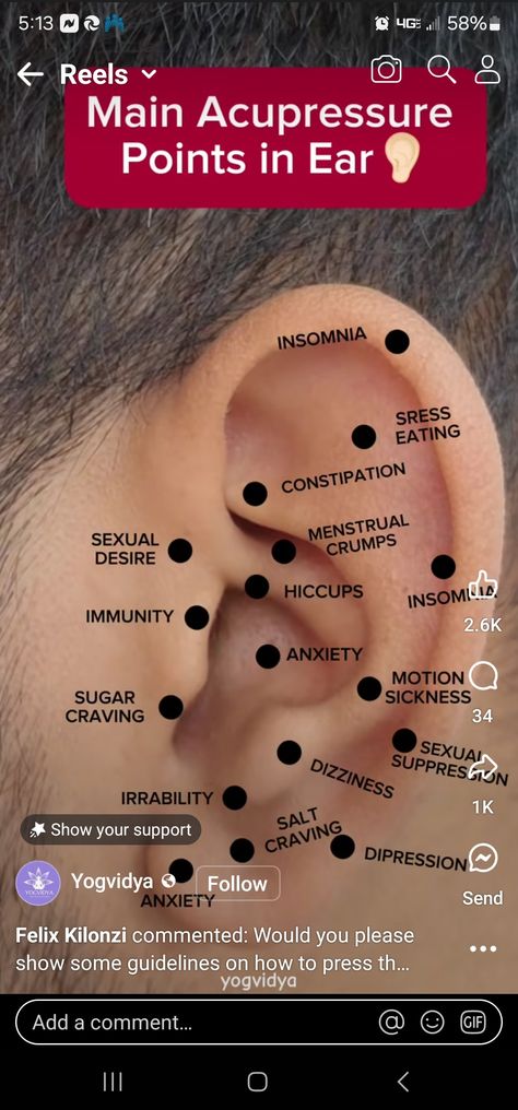 Ear Acupressure Points, Acupressure Points Chart, Acupuncture Points Chart, Healing Reflexology, Lymph Drainage Massage, Pressure Point Therapy, Acupuncture Point, Drainage Massage, Hand Reflexology