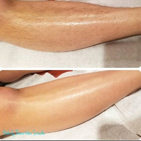 Before and after leg wax. Look how smooth you can be! #dayton #ohio #brazilianwaxing #waxing #esthetician #eyebrowwaxing #lashlift #lashtint #browtint #legwax #beforeandafter Waxing Esthetician, Hair Removal Scrub, Leg Hair Removal, Wax Studio, Hair Removal Diy, Anti Aging Body, Lash Tint, Facial Treatments, Diy Wax