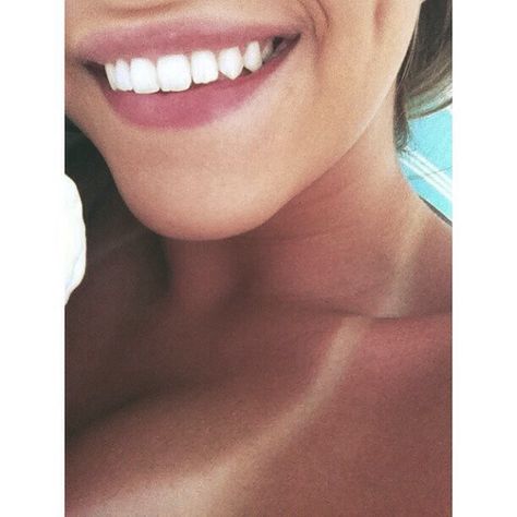 Tan lines , white teeth , Sagging Skin Remedies, Teeth Aesthetic, Pretty Teeth, Teeth Whitening Remedies, Aesthetic Dentistry, Teeth Whitening Diy, Wisdom Teeth Removal, Perfect Teeth, Smile Teeth