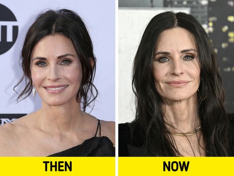 5 Celebrities Who Removed Their Facial Fillers and Loved the Results Facial Balancing Filler, Cosmetic Fillers, Face Fillers, Facial Fillers, Celebrity Plastic Surgery, Minimal Makeup, Cut Her Hair, Beauty Standards, Fresh Face