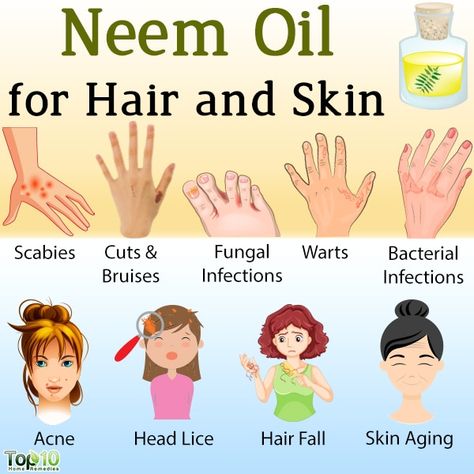 Neem Oil for Hair and Skin: 9 Benefits and How to Use It | Top 10 Home Remedies Benefits Of Neem Oil For Skin, Neem Oil Benefits Hair, How To Make Neem Oil At Home, Neem Oil Benefits Skin, Neem Oil Recipes, Neem Oil Benefits, Neem Oil For Skin, Benefits Of Neem Oil, Neem Benefits