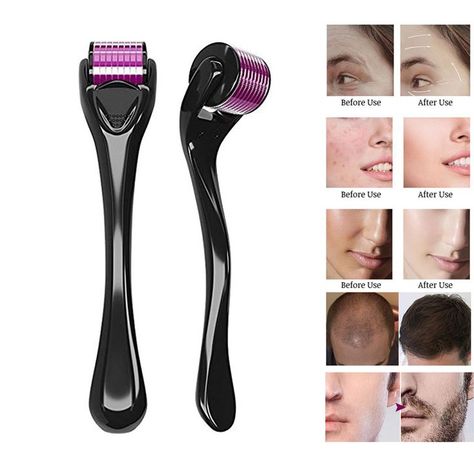 Shopping Background, Microneedle Derma Roller, Derma Rolling, Skin Roller, Functional Nutrition, Micro Needle, Business Pictures, Dark Circle, Beauty Gadgets