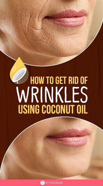 Face Wrinkles Remedies, Wrinkles Remedies, Wrinkles Remedies Face, Get Rid Of Wrinkles, Wrinkle Remedies, Wrinkle Free Skin, Lip Wrinkles, Brown Spots On Face, Skin Care Wrinkles