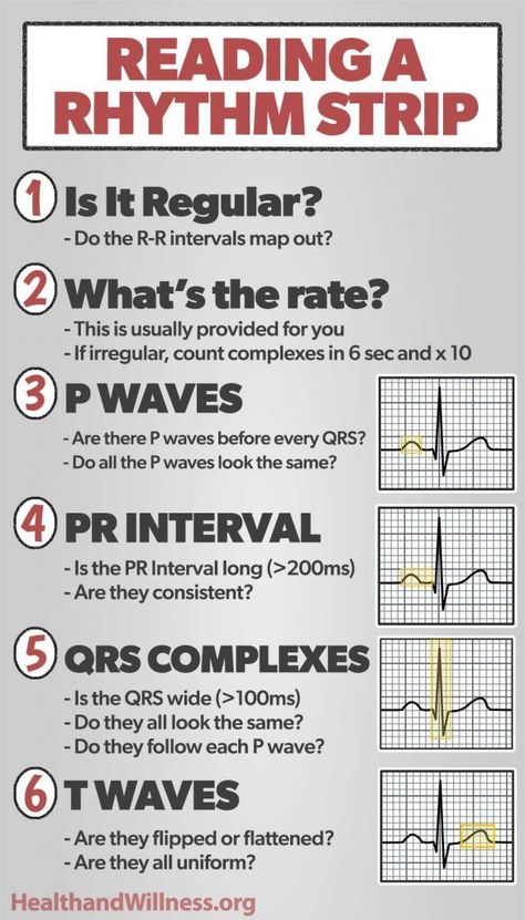 Systematic approach to reading a rhythm strip Heart Rhythm Nursing Cheat Sheets, Lethal Rhythms Ekg, Ekg Rhythms, Cardiac Dysrhythmias Nursing, Cardiac Arrhythmias, Nurse Skills, Cardiology Nursing, Cardiac Rhythms, Medical Assistant Student