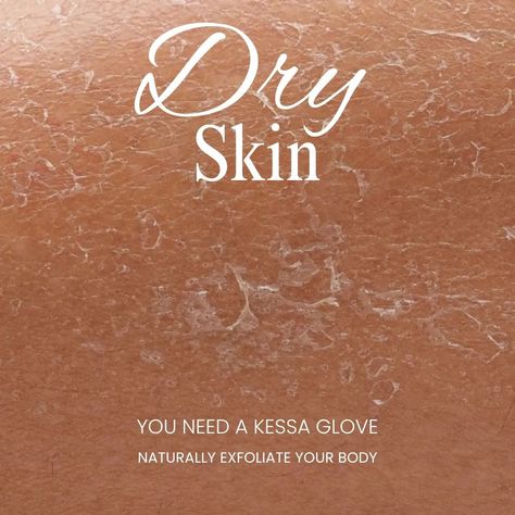 The Kessa exfoliating glove is designed to help remove dead skin cells and improve circulation, which can be particularly beneficial for dry skin. When you use the glove in conjunction with steam or warm water, it helps to soften the skin, making it easier to slough off the dry, flaky layers. This process not only reveals smoother skin underneath but also helps to enhance the absorption of any moisturizers or oils you apply afterward. Regular use can lead to a more radiant and hydrated a... Dry Flaky Skin, Exfoliating Gloves, Flaky Skin, Improve Circulation, Smoother Skin, Dead Skin, Skin Cells, Dry Skin, Warm Water