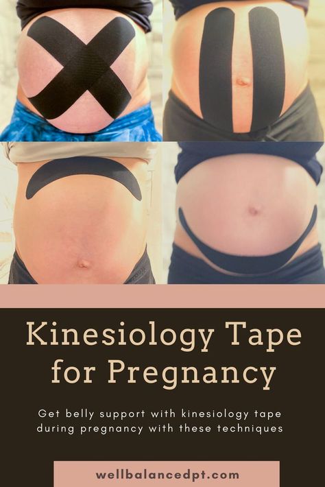 With additonal weight in your abdomen, using kinesiology tape can help take pressure off your stomach and low back to reduce pain and discomfort. Click to read more information. Kinestiotape, Pregnancy, Stomach Support, Low back pain and pregnancy. K Tape Pregnancy, Pregnancy Belly Taping, Pregnancy Tape Belly, Belly Taping For Pregnancy, Kinesiology Taping Pregnancy, Kt Tape Pregnancy, Pregnancy Running, Pregnancy Back Pain, K Tape