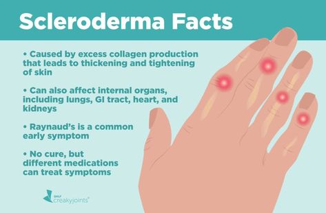 Scleroderma Symptoms, Scleroderma Awareness, Autoimmune Disease Symptoms, Auto Immune, Health Podcast, Gi Tract, Lung Disease, Scar Tissue, Autoimmune Disease