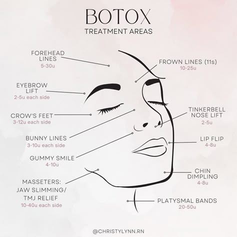 Botox Astetic, Med Spa Injection Room, Beauty Injections Aesthetic, Face Botox Areas, Botox Training For Nurses, Botox Price List, Botox Units Needed, Botox Fillers Quotes, Botox Maintenance