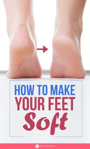 Homemade Foot Cream, Nails Remedies, Heels Tips, Diy Nail Care, Foot Care Tips, Pedicure Tips, Diy Pedicure, Foot Pedicure, Hand And Foot Care