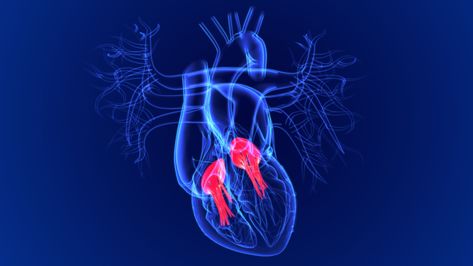 Tricuspid regurgitation, "leakage" of the tricuspid valve, is a relatively common heart valve disorder that needs careful evaluation Mitral Valve Regurgitation, Bicuspid Aortic Valve, Heart Valve, Tricuspid Valve, Mitral Valve, Heart Valves, Open Heart Surgery, Types Of Surgery, Medicine Journal