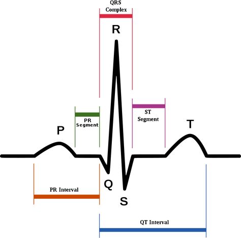 How To Read An EKG (electrocardiograph) Ekg Rhythms, Ekg Interpretation, Normal Sinus Rhythm, Ecg Interpretation, Pr Interval, Cardiac Rhythms, Medical Library, Cardiac Nursing, Atrial Fibrillation