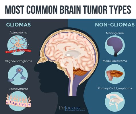 Cavernous Malformation, Neuro Nursing, Brain Surgery Recovery, Brain Tumour, Brain Tumors, Hyperbaric Oxygen Therapy, Brain Surgery, Nerve Cell, Mental Energy