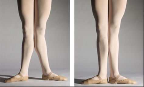 Hyperextended vs non hyperextended Ballet Legs Exercises, Ballerina Legs Workout, Ballet Hyperextension, Ballerina Legs Muscle, Hyperextended Knee, Ballerina Legs, Ballet Basics, Beginner Ballet, Dance Workshop