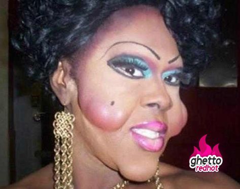 22 Plastic Surgeries Gone Way Wrong ~~FTW? Plastic Surgery Pictures, Botched Plastic Surgery, Bad Plastic Surgeries, Plastic Surgery Fail, Plastic Surgery Gone Wrong, Gone Wrong, Body Modifications, Crazy People, Cosmetic Surgery