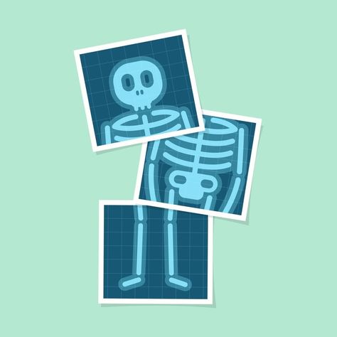 conjunto de película de rayos x del cuerpo de dibujos animados del cuerpo humano. Radiologist Wallpaper, Body Cartoon, Ux Design Principles, Medical Stickers, Vector Animation, Basic Anatomy And Physiology, Medical Wallpaper, Cartoon Human, X Picture