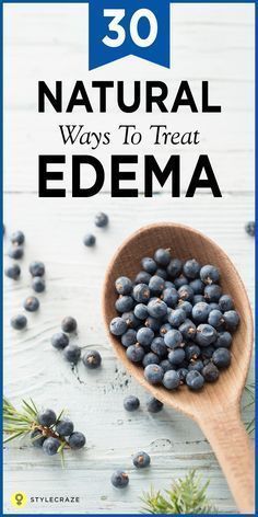 Swollen ankles and feet, puffy eyes and a general feeling of heaviness — yes, you may have edema. Edema, in simpler terms, is water retention. Water tends to accumulate between cells in your soft tissue and can occur due to many conditions. Here are 30 effective home remedies to treat edema. #HomeRemedies #UTI #remedies #natural #healing Autogenic Training, Water Retention Remedies, Swollen Ankles, Healthy Diet Tips, Water Retention, Good Health Tips, Healthy Food Choices, Healthy Eating Tips, Puffy Eyes