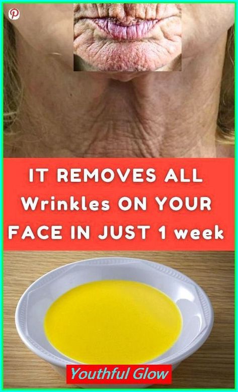 IT REMOVE ALL WRINKLES ON YOUR FACE IN JUTS 1 WEEK Wrinkle Remedies Face, Eyelid Wrinkles, Best Wrinkle Filler, Diy Hair Removal, Natural Wrinkle Remedies, Face Wrinkles Remedies, Wrinkles On Face, Face Wrinkle, Home Remedies For Wrinkles