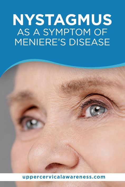 Meniers Disease Symptoms, Ménière’s Disease Diet, Menieres Disease Symptoms, Ménière’s Disease, Meneires Disease, Epley Maneuver, Upper Cervical Chiropractic, Vertigo Remedies, Migraine Diet