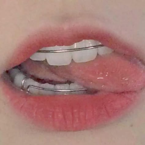 Cute Braces Colors, Braces Girls, Cute Braces, Brace Face, Braces Colors, Teeth Braces, Teeth Jewelry, روتين العناية بالبشرة, Lip Art