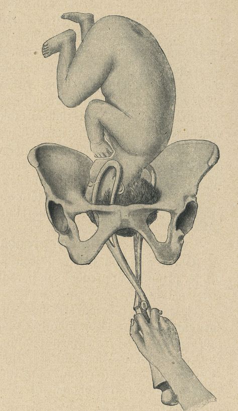 Giving Birth Drawing, Uterus Anatomy Drawing, Anatomical Art, Medical Artwork, Human Body Anatomy, Vintage Medical, Medical Art, Architecture Tattoo, Medical Illustration