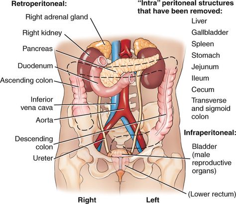 Wk 4 Panc Retroperitoneum structures Retroperitoneal Organs, Anatomy Projects, Ct Anatomy, Nursing Clinicals, Abdominal Cavity, Medical Sonography, Sigmoid Colon, Therapy Business, Diagnostic Medical Sonography