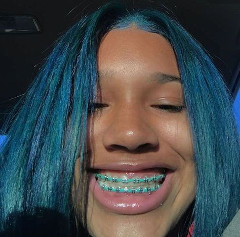 Braces Colors Combinations, Green Braces, Braces Retainer, Braces And Glasses, Maquillage Kylie Jenner, Braces Smile, Cute Braces Colors, Braces Tips