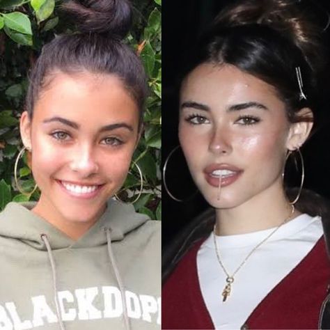 Plastic Surgery Transformation, Madison Beer Before And After Surgery, Madison Beer Side Profile, Plastic Surgery Before And After, Madison Beer Plastic Surgery, Yandere Quotes, Face Transformation, Plastic Surgery Fail, Rhinoplasty Nose Jobs