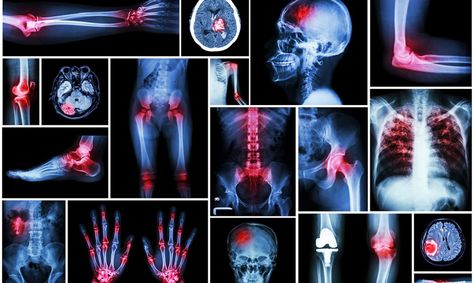 11 Types of Muscle Tension Caused By Trapped Emotions – Awareness Act Repressed Anger, Trapped Emotions, Types Of Muscles, Bolesti Chrbta, Shoulder Tension, Feeling Numb, Tension Headache, Chest Pain, Muscle Aches