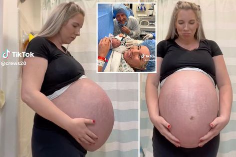 Triplet Baby Bump, Triplets Pregnancy Belly, Pregnant With Triplets Belly, Triplets Pregnancy, Big Pregnant, Baby Bump Pictures, Pregnancy Belly, Triplet Babies, Beautiful Pregnancy