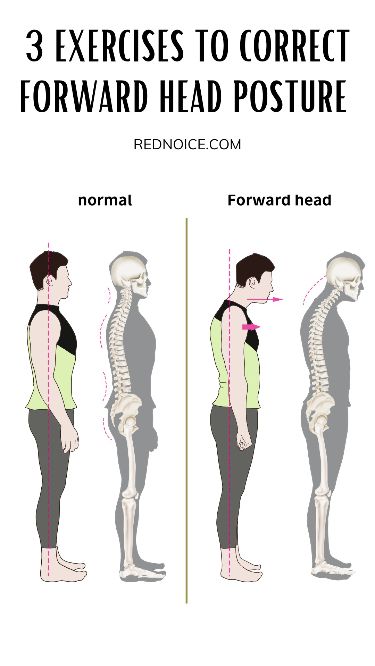 Extended periods of sitting and frequent use of smartphones often contribute to forward head posture, resulting in discomfort in the neck and shoulders. Discover 3 simple corrective exercises for improving forward posture. #posture Forward Head Posture Correction, Exercises For Better Posture, Beginner Stretches, Fix Posture, Forward Head Posture Exercises, Corrective Exercises, Build Core Strength, Better Posture Exercises, Exercises To Do At Home