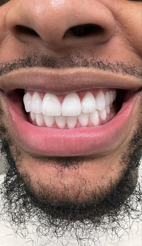 Good Hygiene Aesthetic Men, White Teeth Aesthetic Black, Veneers Black Women, White Teeth Men, Teeth Aesthetic, Pretty Teeth, Get Whiter Teeth, Men Skin Care Routine, Veneers Teeth