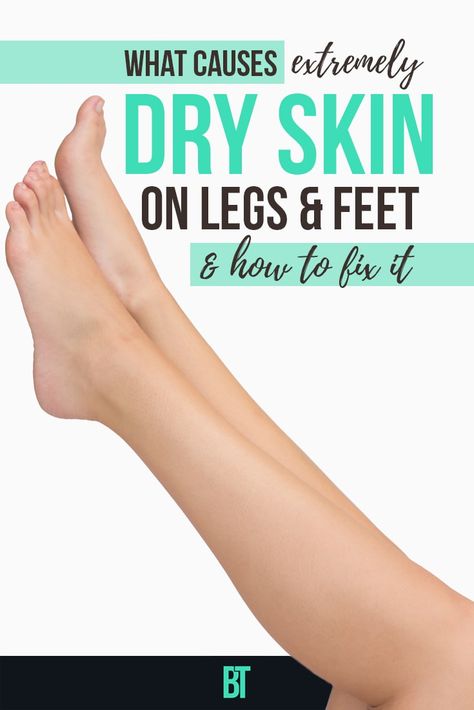 Extremely dry, itchy skin can be a problem! Check what can be the causes and how to treat dry skin on legs and feet. Legs Skin Care, Dry Skin Legs, Itchy Legs, Dry Peeling Skin, Itchy Skin Remedy, Dry Legs, Dry Skin Problem, Extremely Dry Skin, Dry Flaky Skin