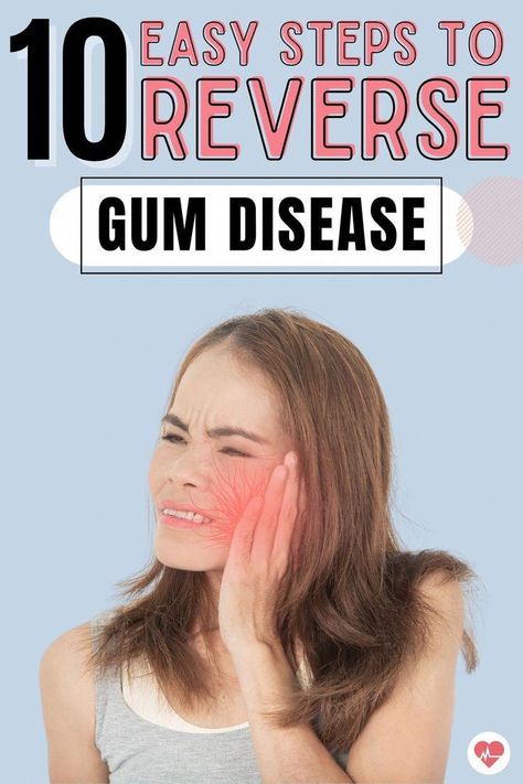 Take control of your oral health! Explore 10 simple and natural ways to reverse periodontal disease. Dive into effective remedies to not only treat but prevent gum disease. Your smile deserves the best care! #OralHealth Gum Inflammation, Swollen Gum, Unwanted Hair Growth, Teeth Health, How To Prevent Cavities, Oral Care Routine, Periodontal Disease, Gum Care, Receding Gums