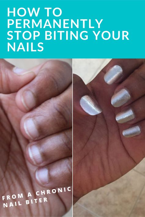 Stop Bitting Nails Tips, Tips For Nail Biters, Nail Biter Nails, How To Stop Nail Biting Habit, Stop Biting Nails Remedies, How To Stop Picking Skin Around Nails, Ways To Stop Biting Your Nails, How To Stop Biting Your Nails Tips, Tips To Stop Biting Nails