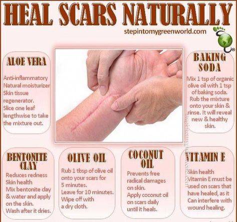 Scar Remedies, Olive Oil Skin, Heart Diet, Types Of Acne, Acne Scar Removal, Skin Tissue, Scar Removal, Scar Tissue, Natural Moisturizer