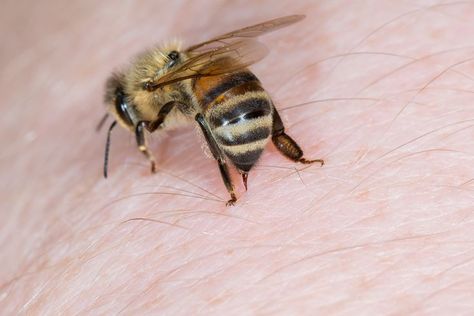 Remedies For Bee Stings, Bee Removal, Bee Venom, Bee Sting, Thick Skin, Humming Bird Feeders, Insect Bites, Stinger, Bee Keeping