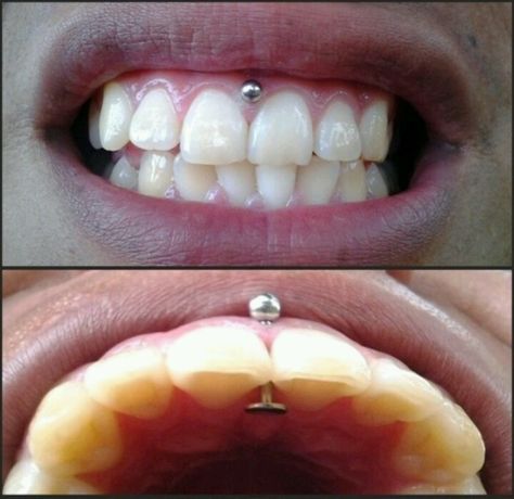 Trans gum piercing.  EW. Its so ugly I just had to post it. Gum Piercing, Justin Bieber Jokes, American Funny Videos, Smiley Piercing, Funny Dresses, Funny Dog Photos, Cool Piercings, Body Piercings, Lip Piercing