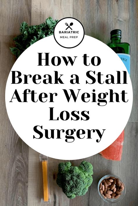 Stalls are common after weight loss surgery. This article gives you realistic tips on how to address them. #bariatricsurgery #weightloss #wls #wlsdiet What To Eat After Gastric Surgery, Bariatric Week 1, Stall After Vsg, Macros For Bariatric Patients, Bariatric Liver Shrinking Diet, Bariatric Maintenance Diet, Gastric Bypass Tips And Tricks, Biatric Sleeve Recipes, Bariatric Diet Plan Post Op