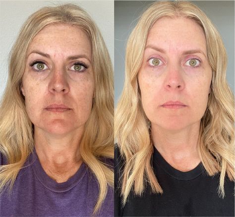 Collagen Results Collagen Before And After Pictures, Taking Collagen, Orange Theory, Collagen Benefits, Help Digestion, Collagen Supplements, Before After Photo, Build Lean Muscle, Beauty Regimen