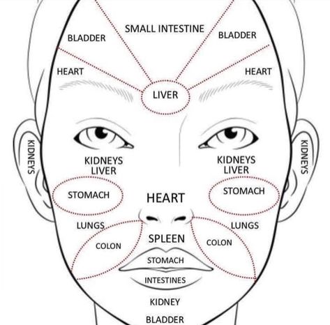 Acne Cream Diy, Face Acne Remedies, Chin Acne Causes, Acne Chart, Best Acne Scar Removal, Acne Scar Removal Cream, Acne Scaring, Face Mapping Acne, Mild Acne