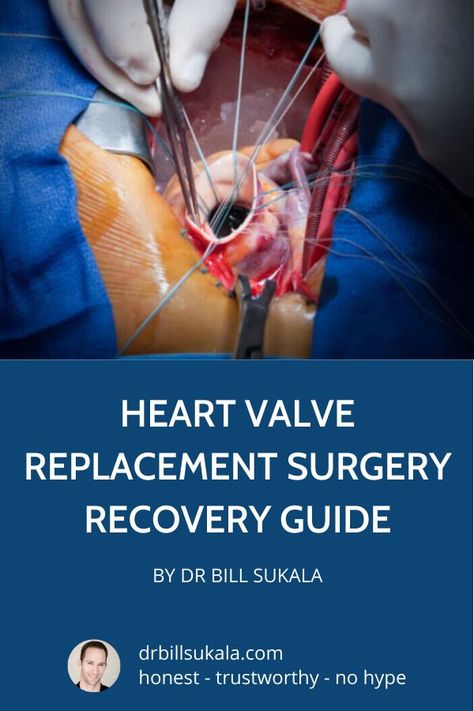 Bicuspid Aortic Valve, Heart Surgery Recovery, Aortic Valve Replacement, Cardiac Rehabilitation, Heart Valve, Mitral Valve, Brain Surgeon, Heart Valves, Medical Videos