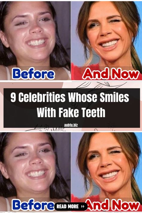 Celebrity Teeth, Picture Perfect Smile, Prettiest Celebrities, Fake Teeth, Good Will Hunting, Internet Games, Smile Makeover, Chris Rock, Perfect Smile