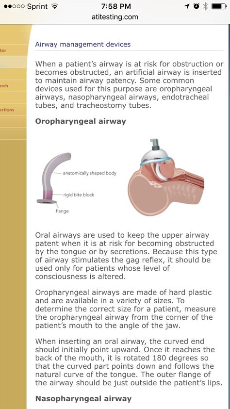 Oral airway Nursing Labs, New Grad Nurse, Airway Management, Medicine Notes, Nurse Study Notes, Nursing Student Tips, Nursing School Survival, Critical Care Nursing, Nursing School Studying