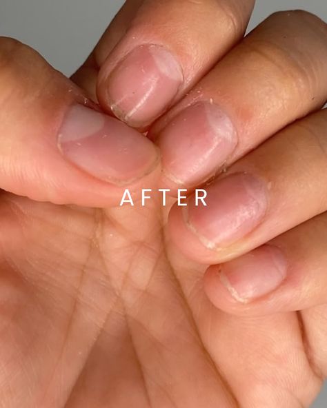 We love this before and after review from Jocelyn on Amazon 🫧 We promise Bubbeau will make all the difference in your cuticle health! Cuticle Health, March 27, Our Love, Love This, Health, On Instagram, Quick Saves, Instagram