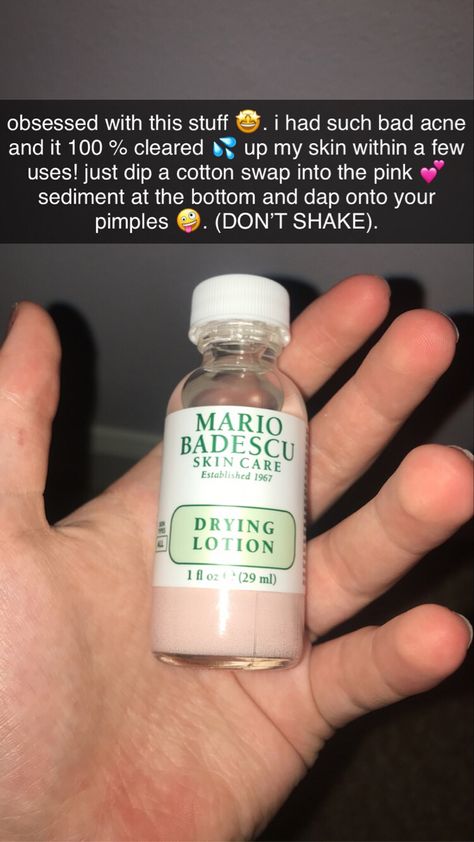 Mario Badescu Drying Lotion, Drying Lotion, Bad Acne, Mario Badescu Skin Care, Country Stuff, Mario Badescu, Care Skin, Clear Skin, Body Lotion