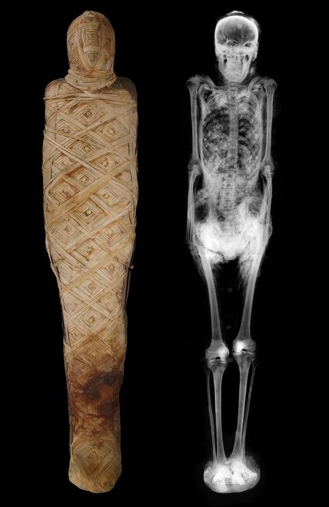 One of the Ancient Egyptian mummies on display in Birmingham Museum and Art Gallery - and an X-ray of the remains Distortion Art, Egypt Mummy, Xray Art, Egyptian Mummies, Alexander Mcqueen Fashion, Tutankhamun, Theatre Arts, Tv Drama, Moon Child