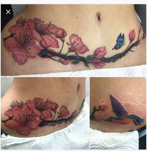 Tuck Tattoos, Tattoo Son, Sakura Tattoo, Scar Cover Up, Tattoos To Cover Scars, Belly Tattoos, Girl Back Tattoos, Kunst Tattoos, Beautiful Flower Tattoos