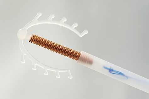 Kveller – My Copper IUD Turned Me Into a Different Person Mirena Iud Removal, Iud Removal, Hormonal Iud, Mirena Iud, Copper Iud, Intrauterine Device, Birth Pictures, Birth Control Methods, Get Schooled