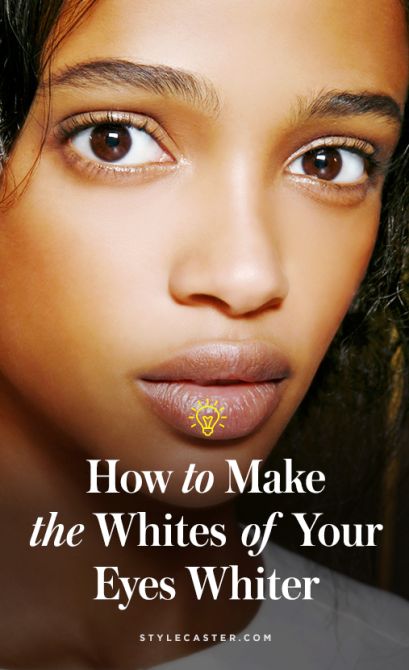 how to make whites of eyes look whiter1 How to Make the Whites of Your Eyes Look Even Whiter Whiten Eyes, Dry Eyes Causes, Eyes Problems, White Eyes, Diy Beauty Hacks, Dry Eyes, Yellow Eyes, Eye Health, Eye Care